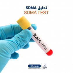 تحليل SDMA